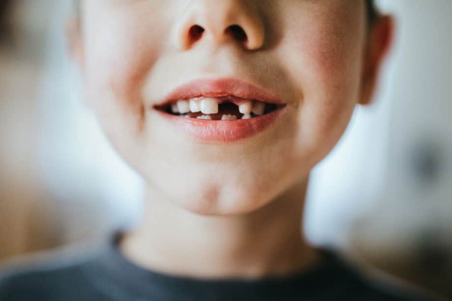 close up of young boy's mouth with missing tooth