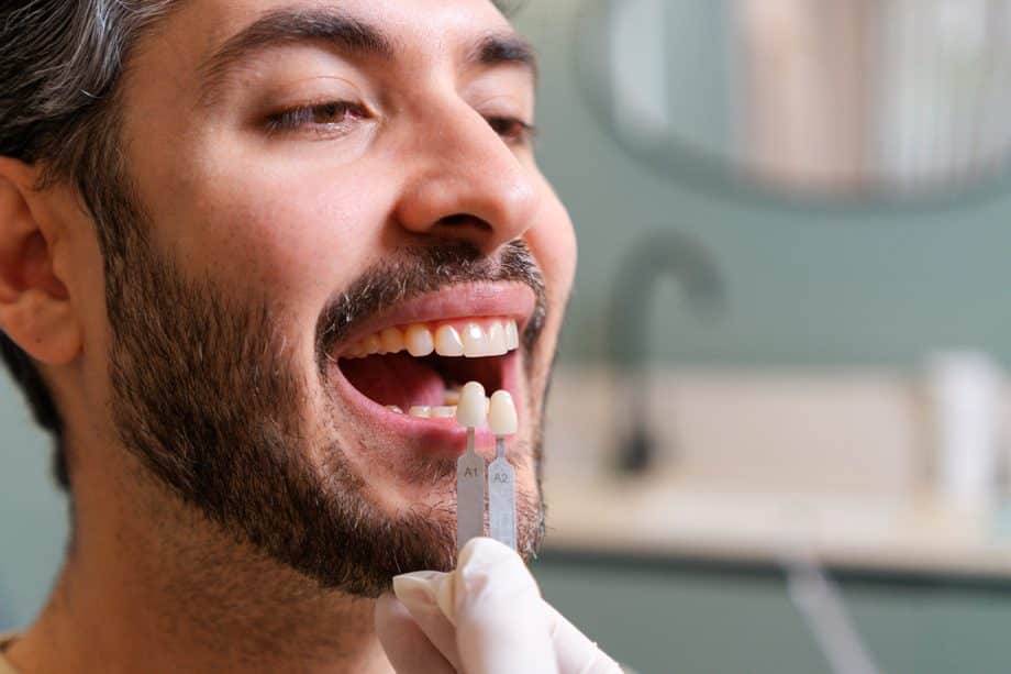 Stainless Steel vs. White Crowns for Baby Teeth: Pros and Cons
