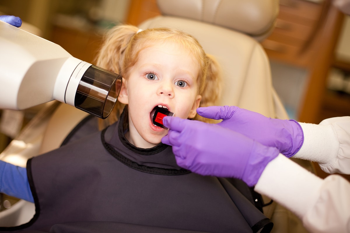 When is it Safe to Give a Child Their First Dental XRay? OCP